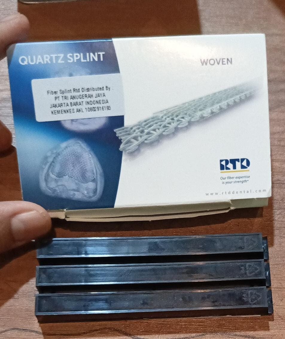 Fiber Splint Woven RTD 2.5 x 80 mm